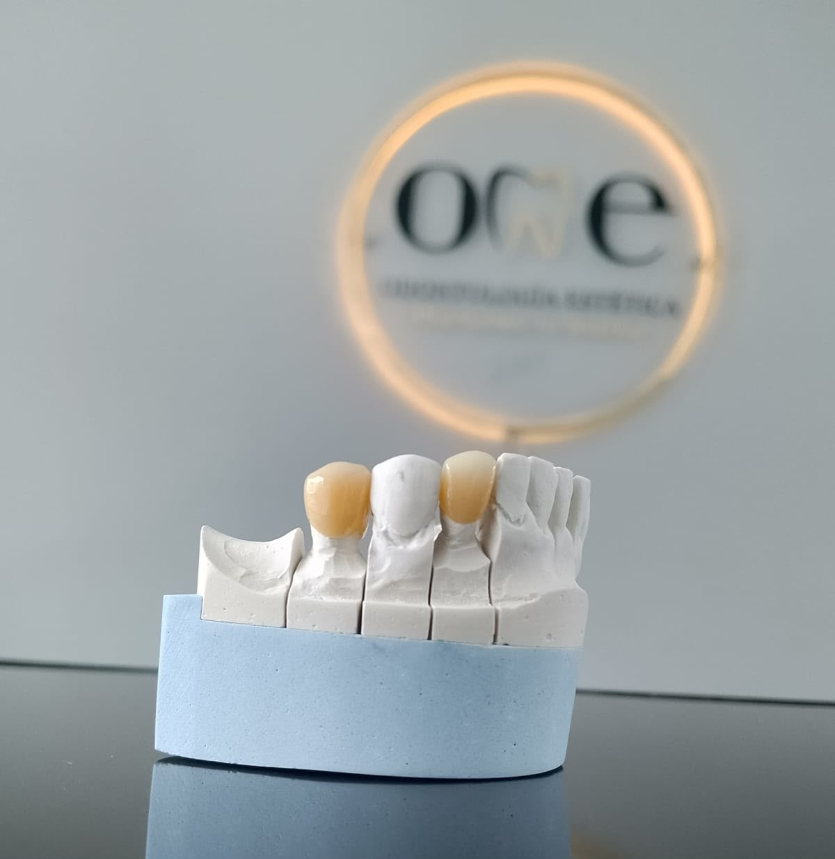 Modelo de trabajo con coronas dentales personalizadas